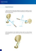 Cemented Hip Joint Cup - type 02/II - 6