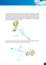 Cemented Hip Joint Cup - type 02/II - 7