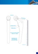 Cementless femoral stem – type SF - 5