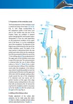 Cementless femoral stem – type SF - 9