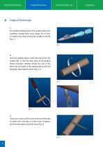 Cerclage System - 4