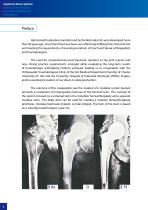 Hip Hemiarthroplasty – type CSB - 2