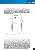 Hip Hemiarthroplasty – type CSB - 9