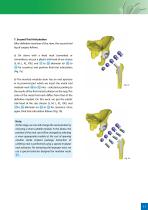 Hip Joint Stem Type BEZNOSKA TRIO - 11