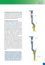 Hip Joint Stem Type BEZNOSKA TRIO - 7