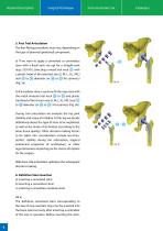 Hip Joint Stem Type BEZNOSKA TRIO - 8