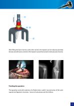 Radial Head Replacement - 7