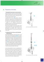 Total Knee Joint Replacement Type CMS - 5