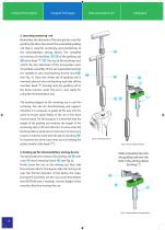 Total Knee Joint Replacement Type CMS - 6