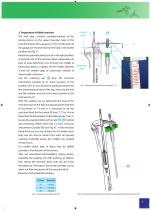 Total Knee Joint Replacement Type CMS - 7