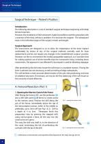 Total Knee Joint Replacement - Type SVL - 4