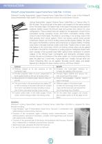 Ortholox Proximal Femur Plate-4