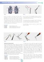 Ortholox Proximal Femur Plate-6