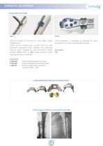 Ortholox Proximal Femur Plate-9
