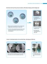 DISPOSABLE PERCUTANEOUS CURVED VERTEBROPLASTY SYSTEM-8