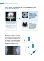 DISPOSABLE PERCUTANEOUS CURVED VERTEBROPLASTY SYSTEM-9