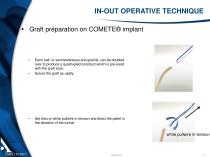 COMETE® / ECLIPSE ® AND ECLIPSE ® BCP SCREW - 11