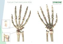 Fracture Charts Hand models 9061 series - 1