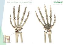 Fracture Charts Hand models 9062 series - 1