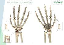 Fracture Charts Hand models 9063 series-1