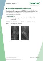 X-Ray Images for preoperative planning - 1