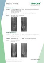 X-Ray Images for preoperative planning - 2