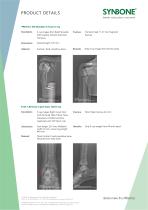 X-Ray Images for preoperative planning - 3