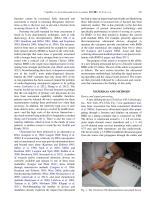 New Desktop Ultrasonic Bone Densitometer-2