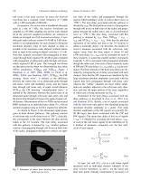 New Desktop Ultrasonic Bone Densitometer-3