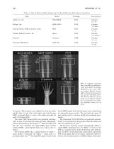 Universal Standardization of Forearm Bone Densitometry-3
