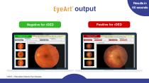 EyeArt® Presentation-5