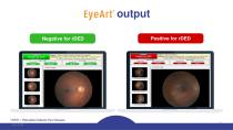 EyeArt® Presentation - Clinical Validations-6