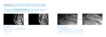 SHOCKWAVE THERAPY-5