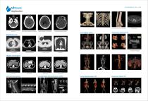 scanner CT64-5
