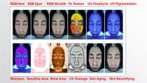 skin analysis system - 7