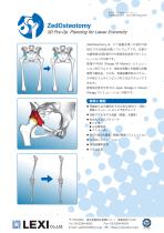 ZedOsteotomy-1