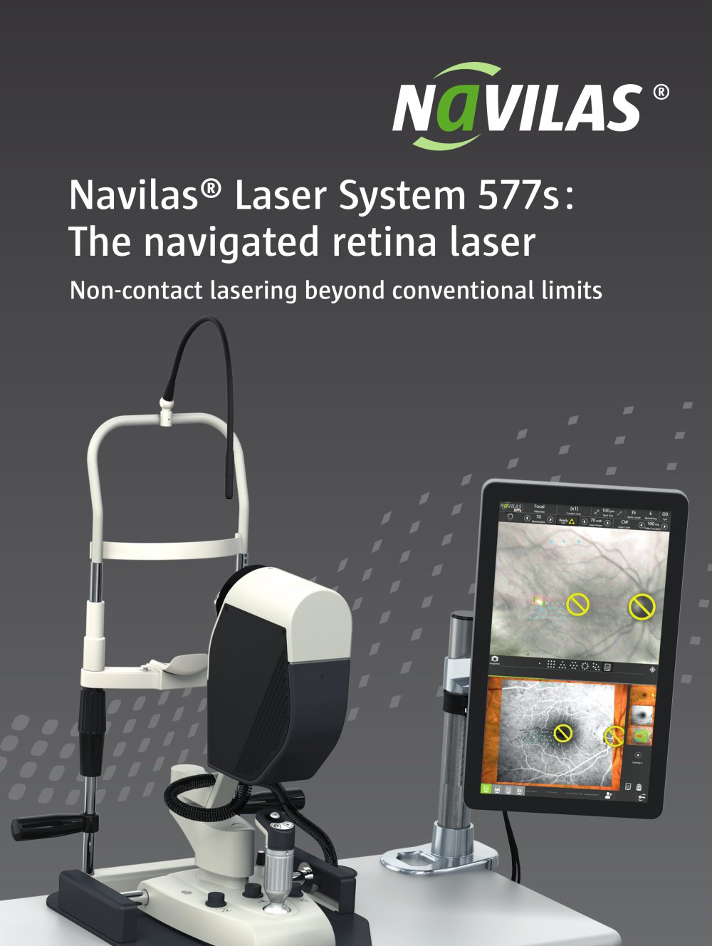 Navilas&reg; 577s - OD-OS