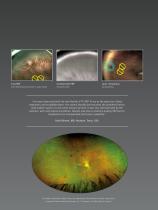 Navilas® 577s Prime Product Brochure-9