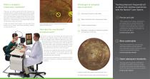 Retinal laser therapy Precise and safe with navigation-2