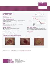 ActiGraft Case Studies-4