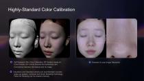 3D Skin Analyser-3