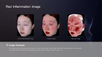 3D Skin Analyser-5