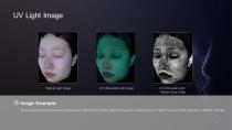3D Skin Analyser-7