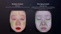 3D Skin Analyser-8