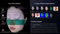 3D Skinvista Skin Analyser -Skin condition analysis system-4