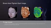 3D Skinvista Skin Analyser -Skin condition analysis system-6