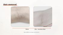 DPL PLUS Hair Removal + Filter DPL Skin Care-15
