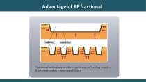 Micro needle RF face lifting machine-7
