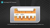 Pinxel-2 Microneedling RF-8