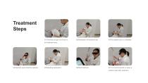 Portable Q Switch ND YAG Laser SQ-1-12